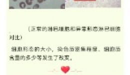 一场从血常规到血液形态的探索之旅